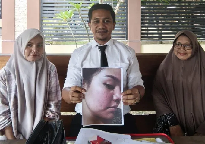 Kuasa Hukum Protes Penanganan Kasus Polisi Aniaya Adik Kandung di Bireuen