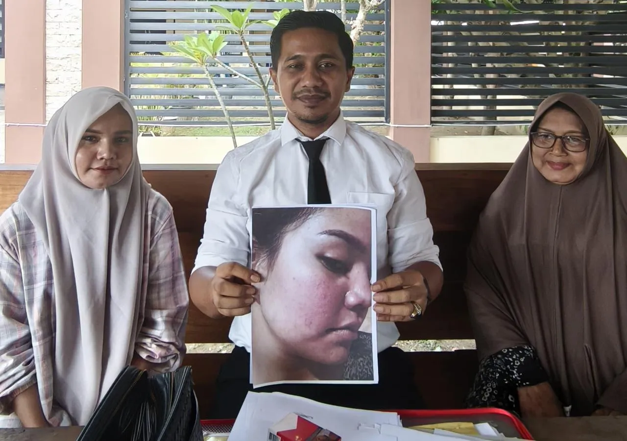 Kuasa Hukum Protes Penanganan Kasus Polisi Aniaya Adik Kandung di Bireuen