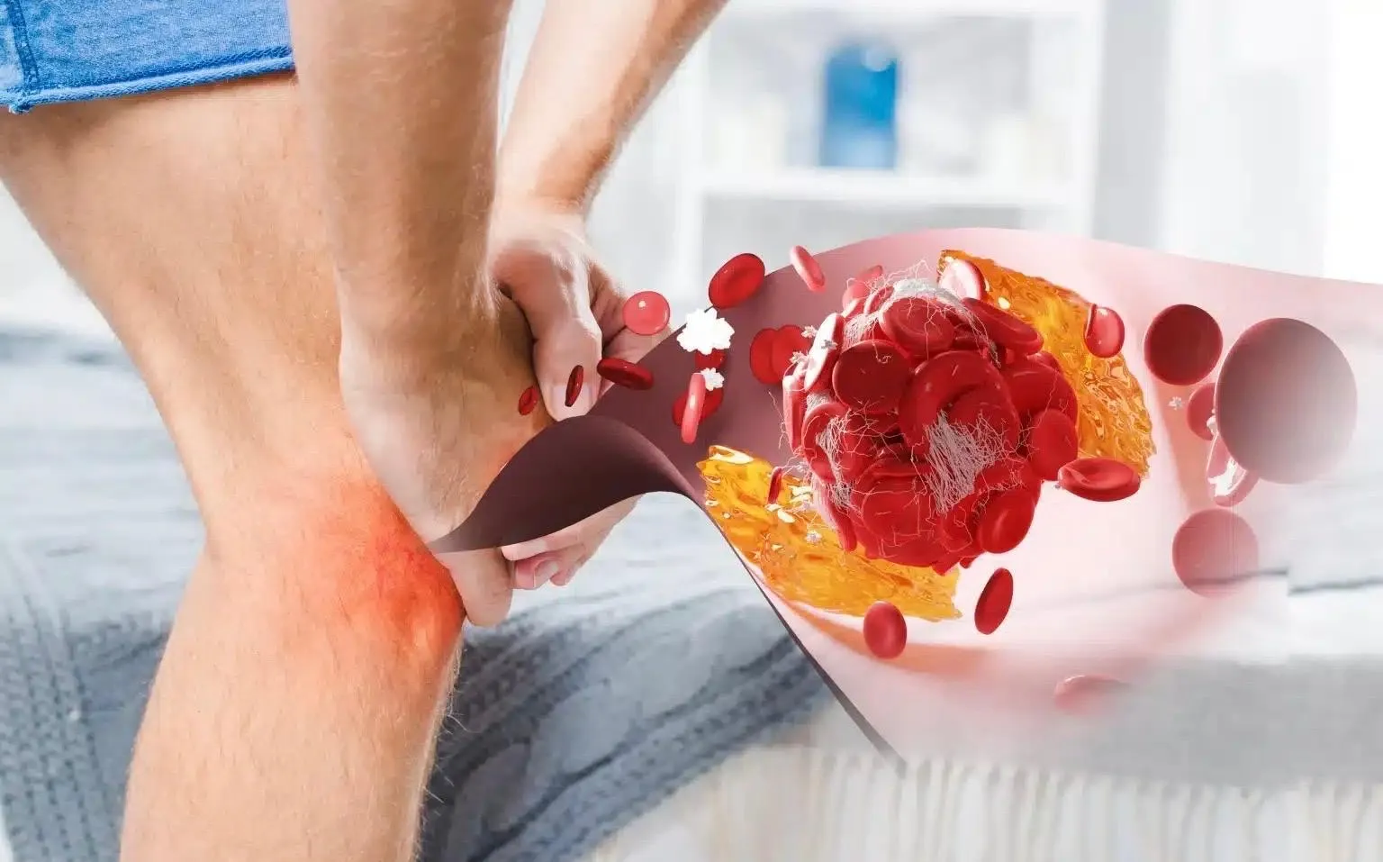 6 Sayuran yang Sebaiknya Dibatasi Penderita Asam Urat