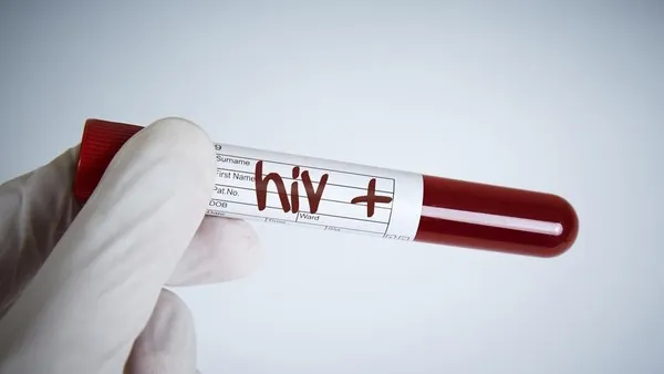 Kasus HIV/AIDS Banda Aceh Capai 918 Orang, 43 Kasus Baru di Temukan 2026