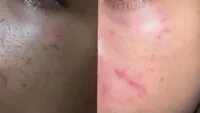 Siswa SMA di Banda Aceh Diduga Dibully dan Dikeroyok Abang Leting