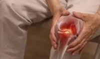 Sering Nyeri Lutut? Waspada Gejala Osteoarthritis Sejak Dini
